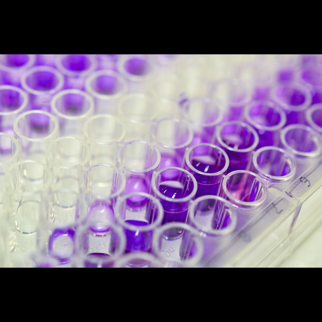 Fish growth hormone,GH ELISA Kit size: 96 Tests